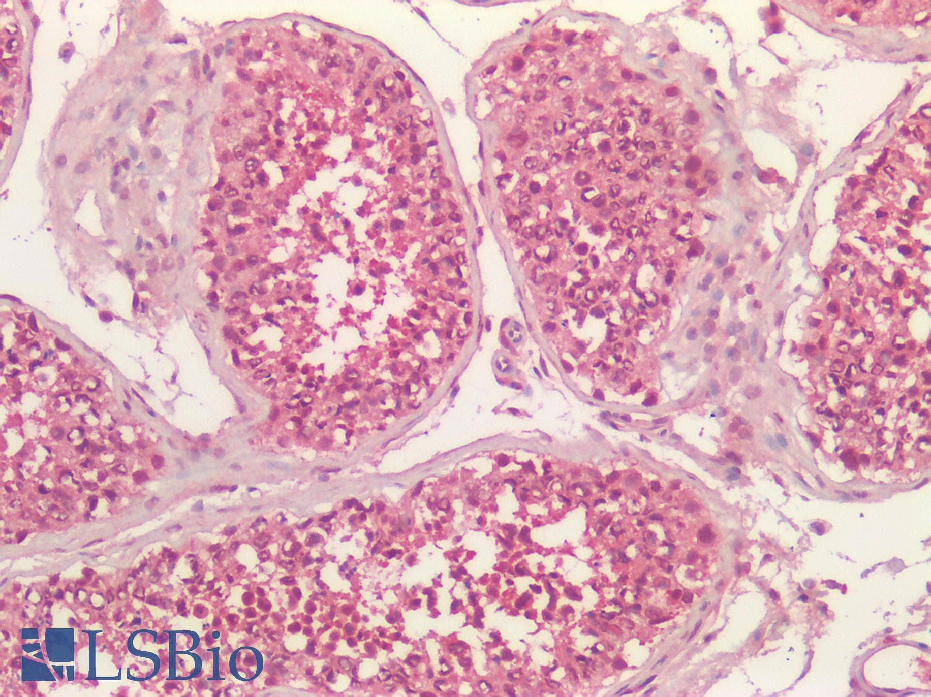 OTUB1 / OTU1 Antibody (clone AT17E10)