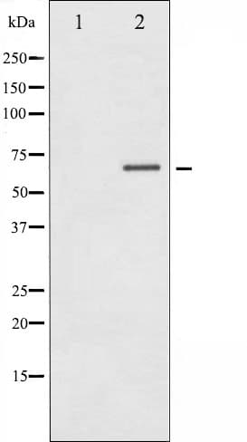 STK11 / LKB1 Antibody (phospho-Thr189)