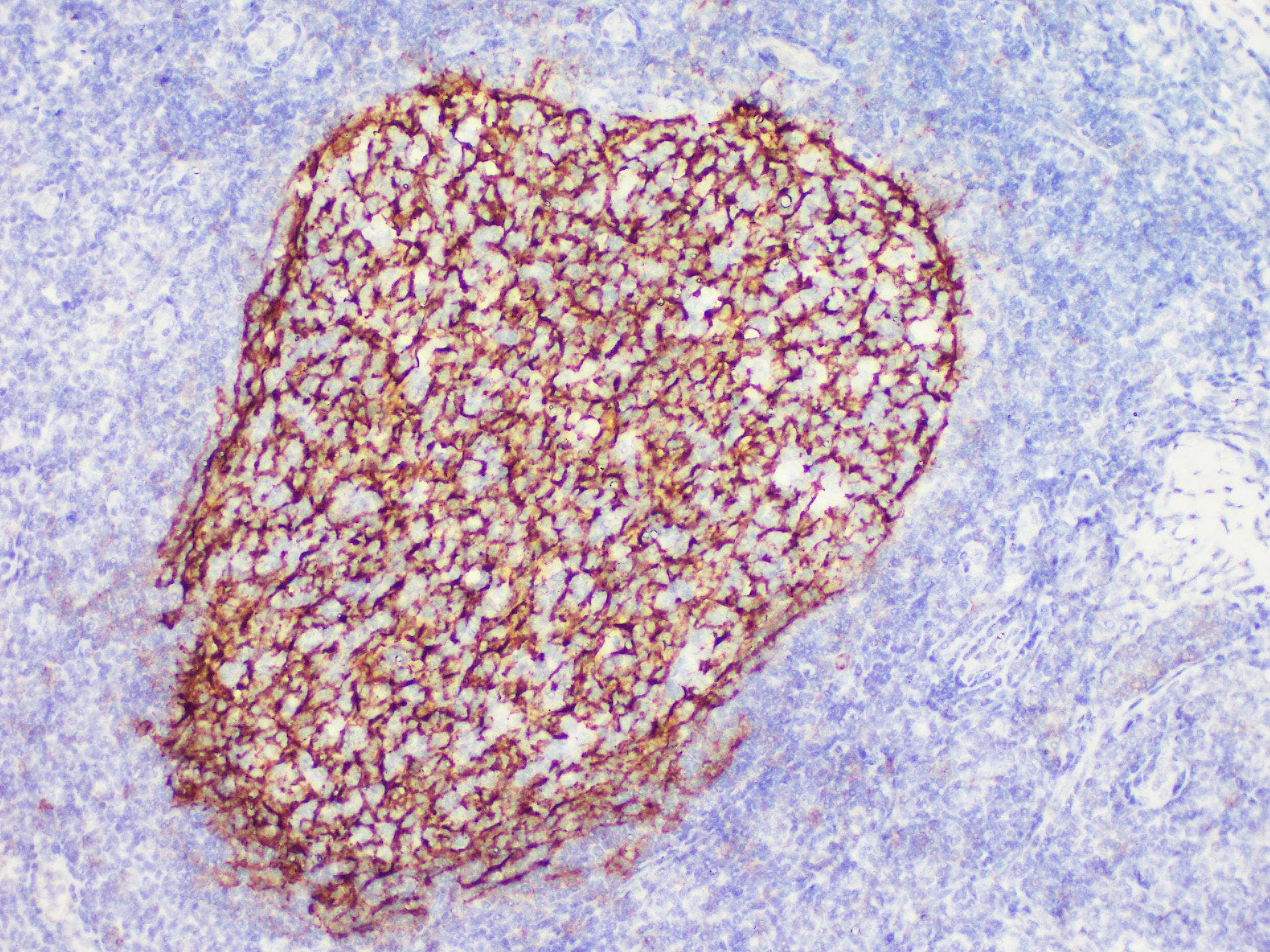 CR2 / CD21 Antibody