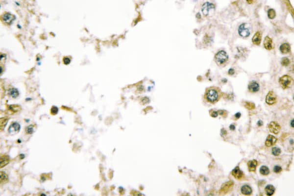 Polyclonal Rabbit anti-Human Securin / PTTG1 Antibody (Leu149, IHC, IF, WB)