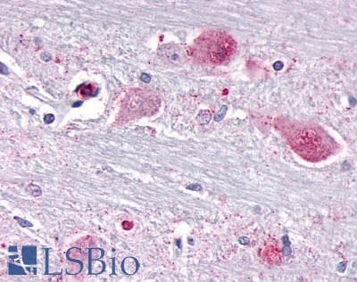 PathPlus™ NR1D1 Antibody (Internal)