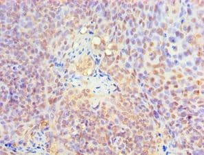 Polyclonal Rabbit anti-Human KLF4 Antibody (aa30-230, IHC, WB)