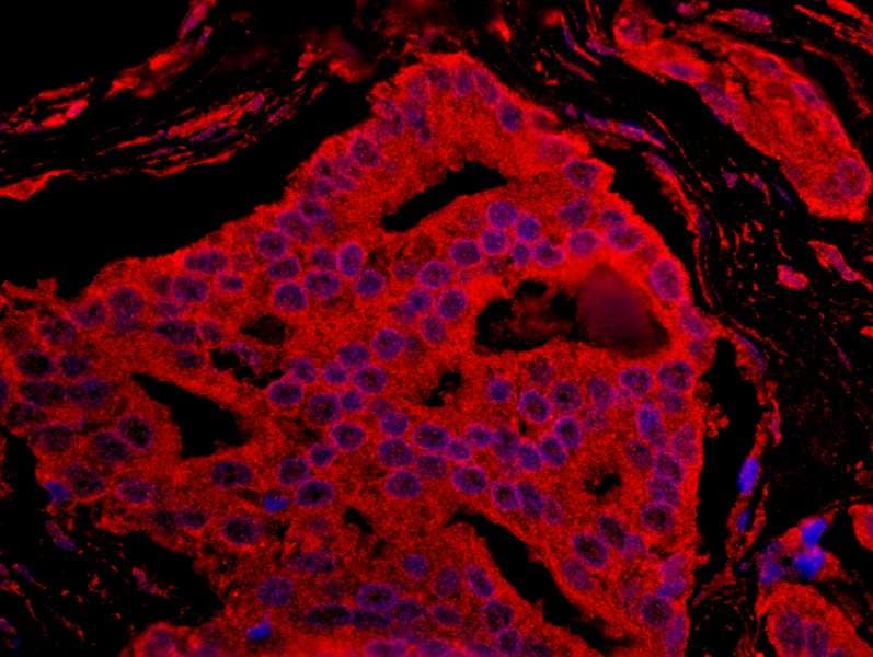 BAD Antibody (aa1-50)