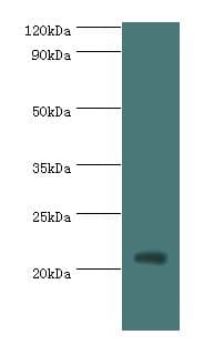 H1F0 Antibody (aa1-194)