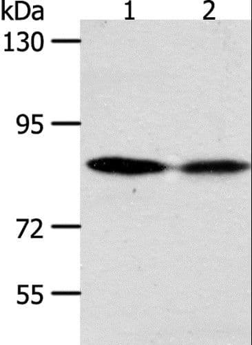 Polyclonal Rabbit anti-Human ADAM11 Antibody (IHC, WB)