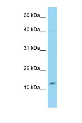 Polyclonal Rabbit anti-Human GOLGA7B Antibody (N-Terminus, WB)
