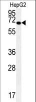 KEAP1 Antibody (aa422-449)