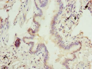 CHIA / Amcase Antibody