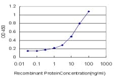 IHC-plus™ Monoclonal Mouse anti-Human GOK / STIM1 Antibody (clone 5A2, IHC, IF, WB)