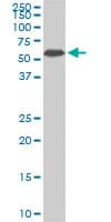IHC-plus™ AAAS / Adracalin Antibody (clone 5A1)