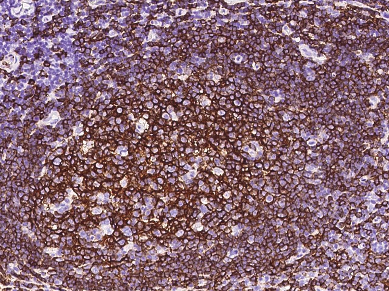 Monoclonal Mouse anti-Human CD20 Antibody (clone 06, Preservative Free, IHC)