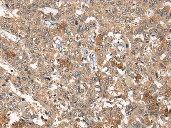 Polyclonal Rabbit anti-Human COPD / ARCN1 Antibody (IHC)