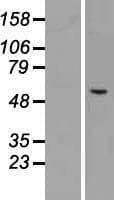 CHST3 Protein (Over-Expression Lysate Myc-DDK (Flag))