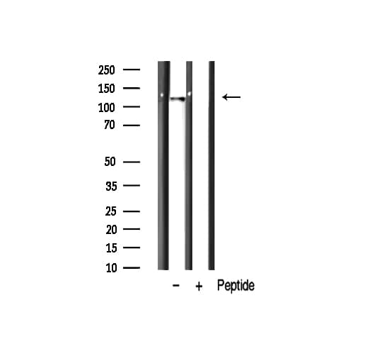 RBM26 / SE70 Antibody