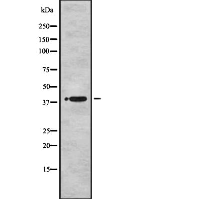 MBNL1 / MBNL Antibody (aa362-388)