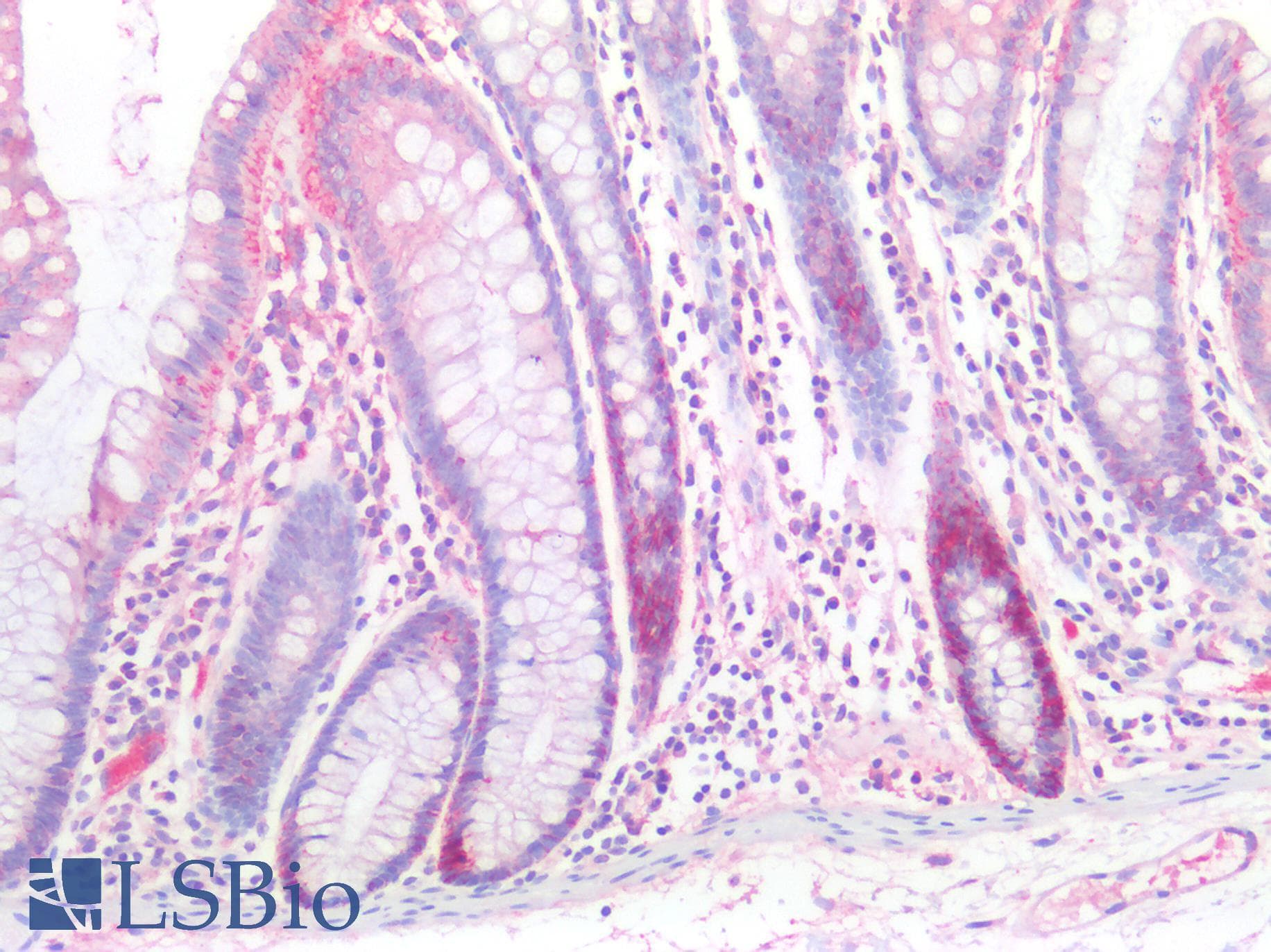 PLCL2 Antibody