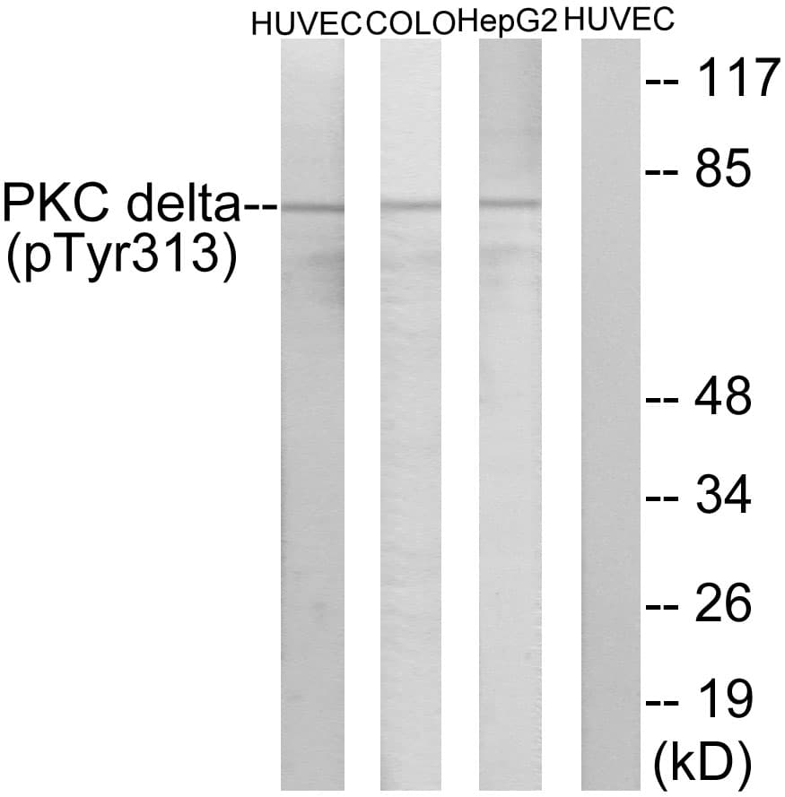 PRKCD / PKC-Delta Antibody (phospho-Tyr313)