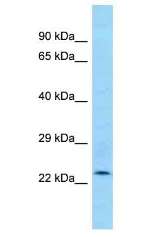 Polyclonal Rabbit anti-Mouse ANKRD46 Antibody (aa179-228, WB)