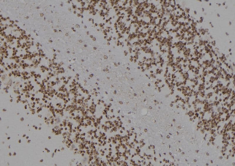 KCNJ11 / Kir6.2 Antibody