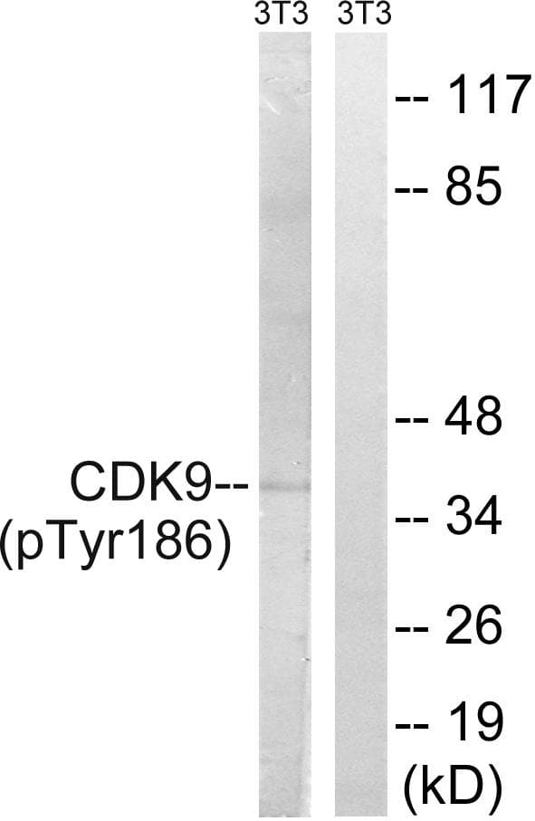 CDK9 Antibody (phospho-Thr186)