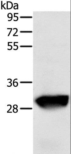 Polyclonal Rabbit anti-Human GSTO1 Antibody (IHC, WB)