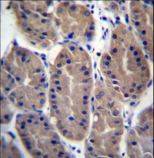 FRMD7 Antibody (aa115-144)