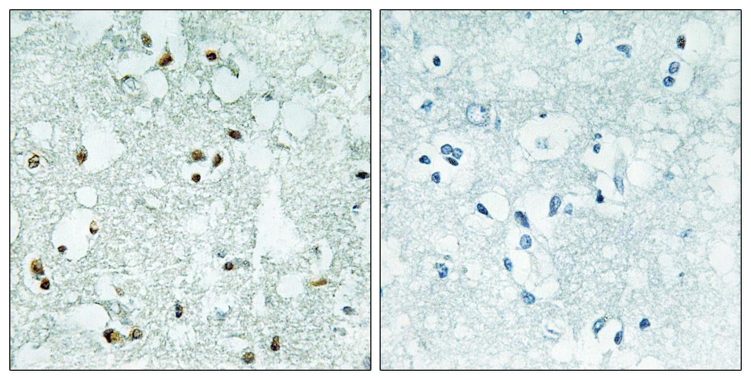 ELAC2 Antibody