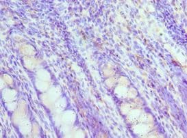 MAD2L1 / MAD2 Antibody (aa1-205)