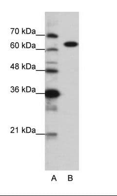 KARS Antibody (C-Terminus)