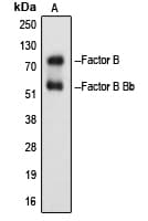 CFB / Complement Factor B Antibody (Internal)