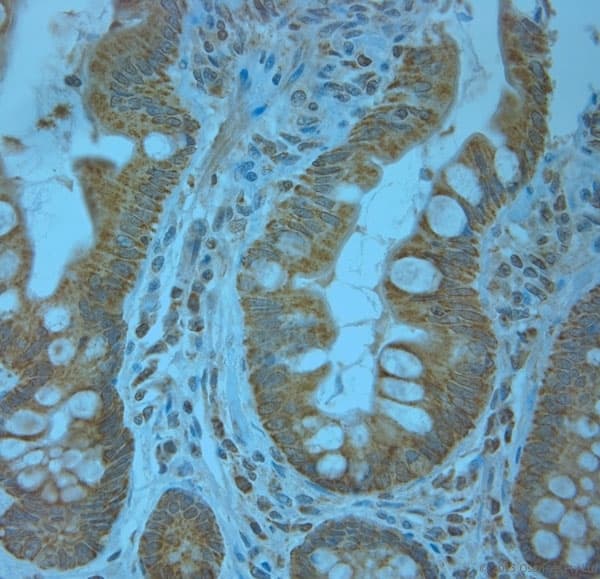 KCNJ13 / KIR7.1 Antibody (aa2-50)
