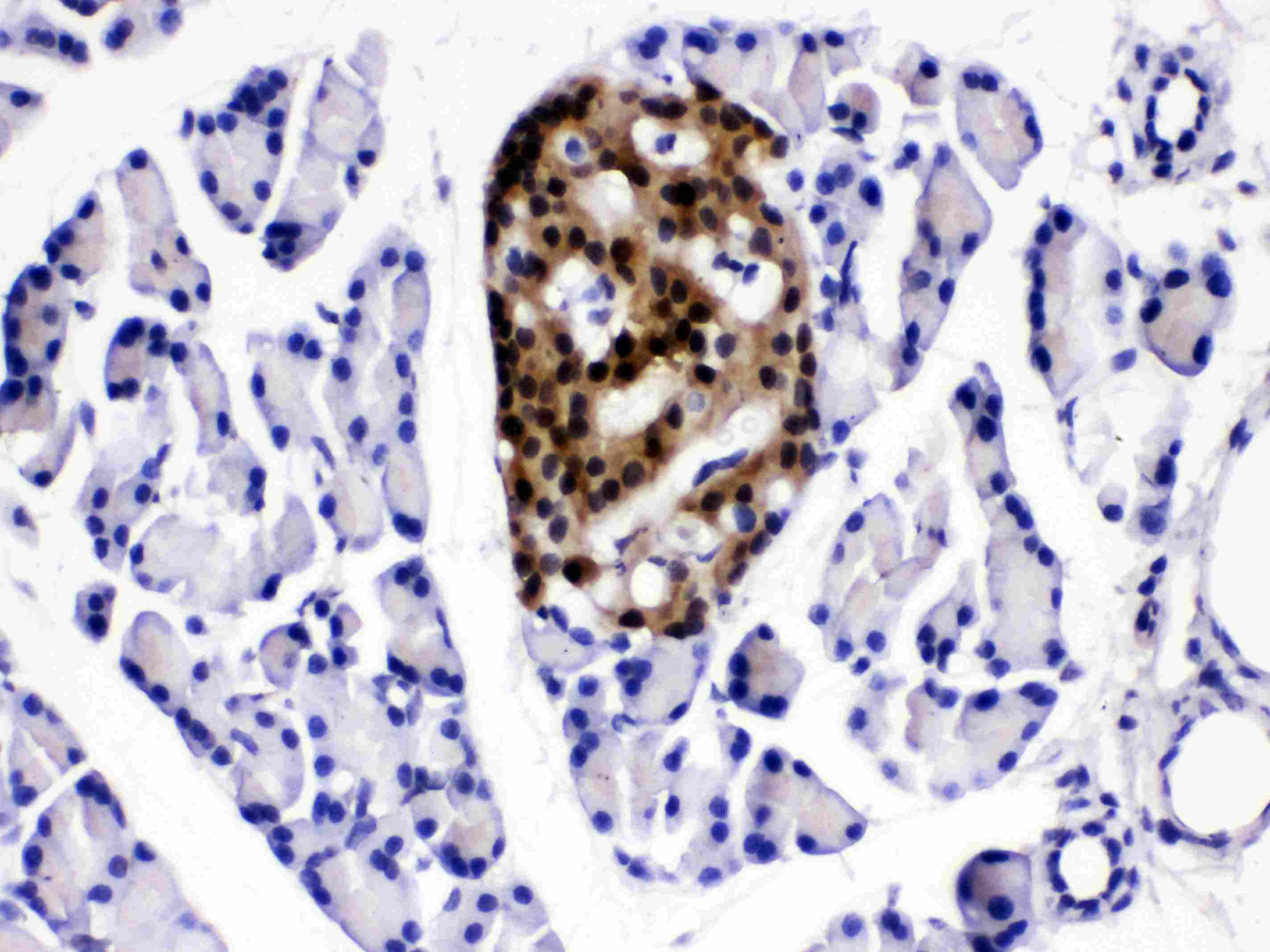 ACLY / ATP Citrate Lyase Antibody