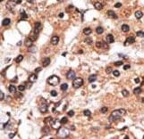 MLLT3 / AF9 Antibody (aa471-502)
