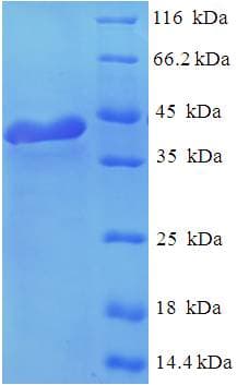 Human RGS2 Protein (Recombinant 6His-SUMO, N-terminus)