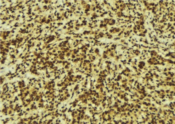 Polyclonal Rabbit anti-Human RELA / NFKB p65 Antibody (Acetyl-Lys310, IHC, IF, WB)
