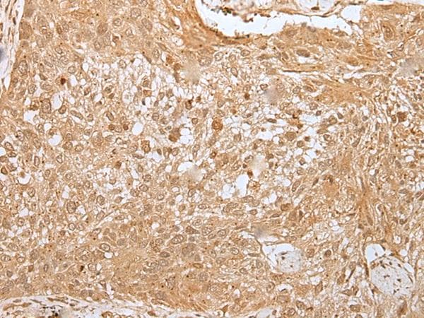 MORF4L1 / MRG15 Antibody
