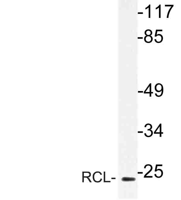 C6orf108 Antibody (Ile42)