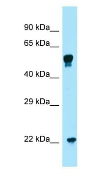 Polyclonal Rabbit anti-Human COQ7 Antibody (aa97-146, WB)
