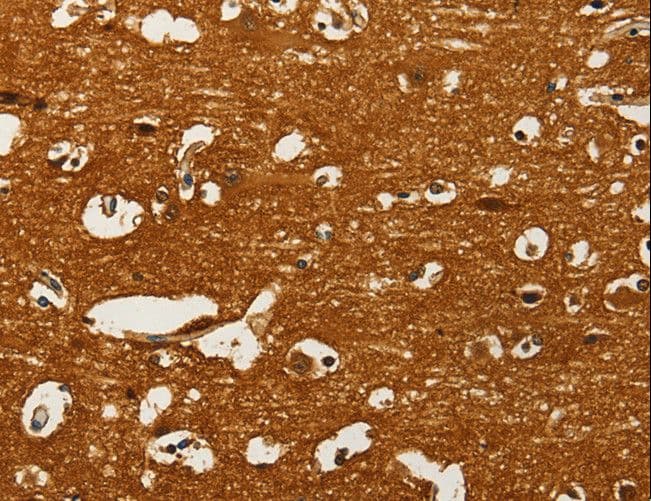 Aspartate Aminotransferase Antibody