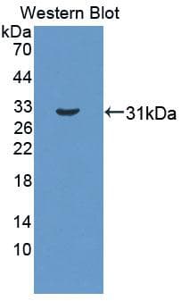 CTBP1 / CTBP Antibody (aa1-250)