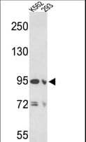EMILIN1 / EMI Antibody (aa84-112)