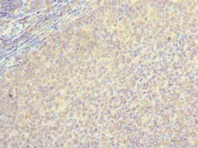 LOH12CR1 Antibody