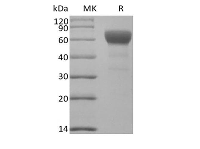 Mouse TGFBR2 Protein (Recombinant Fc, C-terminus)