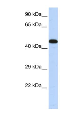 AKAP5 / AKAP79 Antibody (C-Terminus)