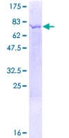 Human NAPRT Protein (Recombinant GST)
