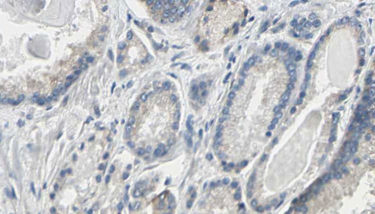 Polyclonal Rabbit anti-Human PGLS / 6PGL Antibody (IHC, IF, WB)