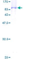 Human RNMT / HCM Protein (Recombinant GST)
