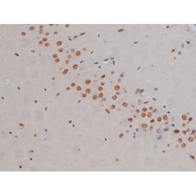 Polyclonal Rabbit anti-Human CHUK / IKKA / IKK Alpha Antibody (phospho-Ser180,phospho-Ser181, IHC, IF, WB)