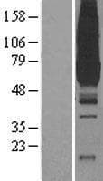 PKLR Protein (Over-Expression Lysate Myc-DDK (Flag))