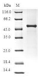 Human FGF14 Protein (Recombinant GST, N-terminus)